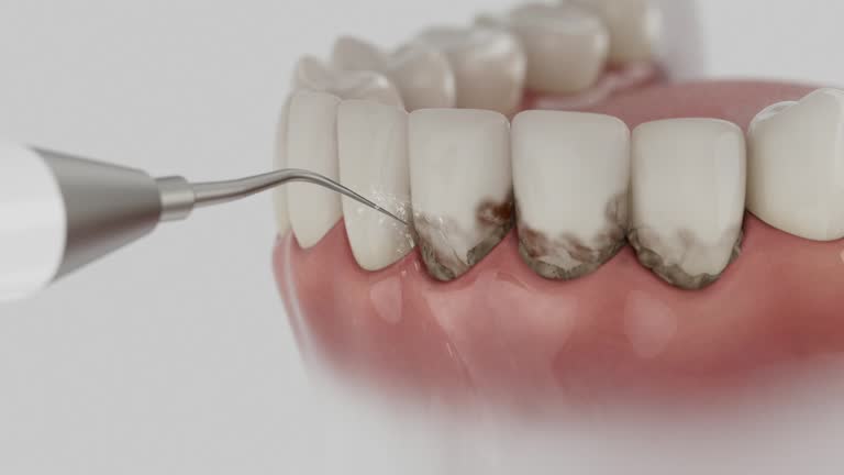 Reliable Dental contractor in Marion, TX by Smile Center Dentistry